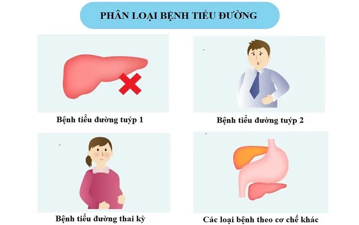 Bệnh Tiểu Đường Có Mấy Tuýp? Phân Biệt Các Loại Đái Tháo Đường Phổ Biến Nhất Bệnh Tiểu Đường Có Mấy Tuýp? Phân Biệt Các Loại Đái Tháo Đường Phổ Biến Nhất